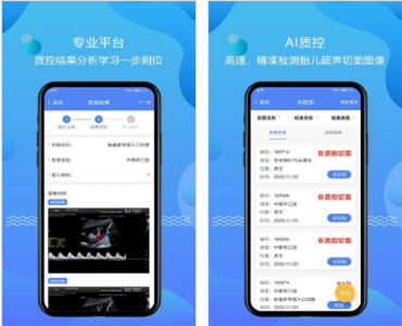 超声智库云会诊软件 超声智库云会诊软件