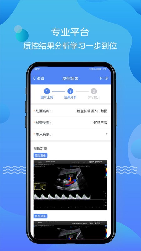 超声智库手机版免费 v1.0.8