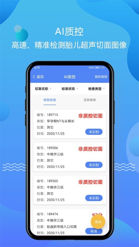 超声智库手机版免费 v1.0.8