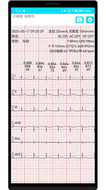 小蜜蜂心电传感器 v1.0.1.2