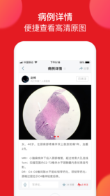 爱病理 v1.9.9