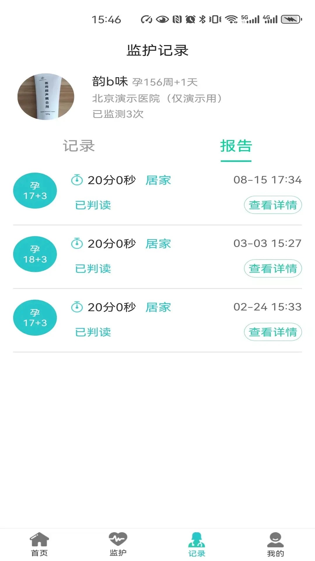 胎心监护 v1.0.24