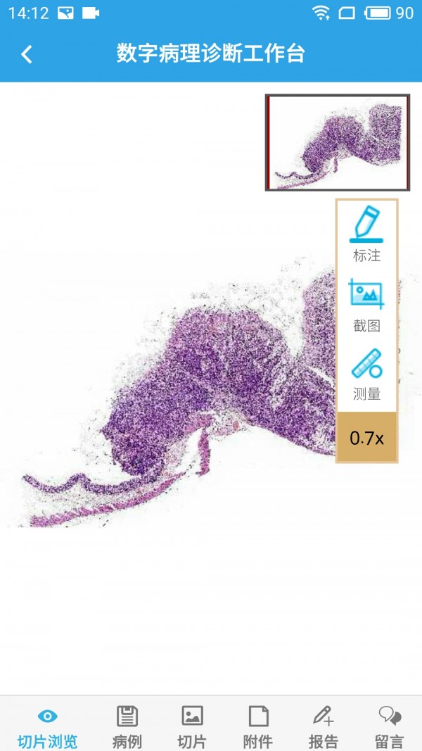 病理通 v1.0.1