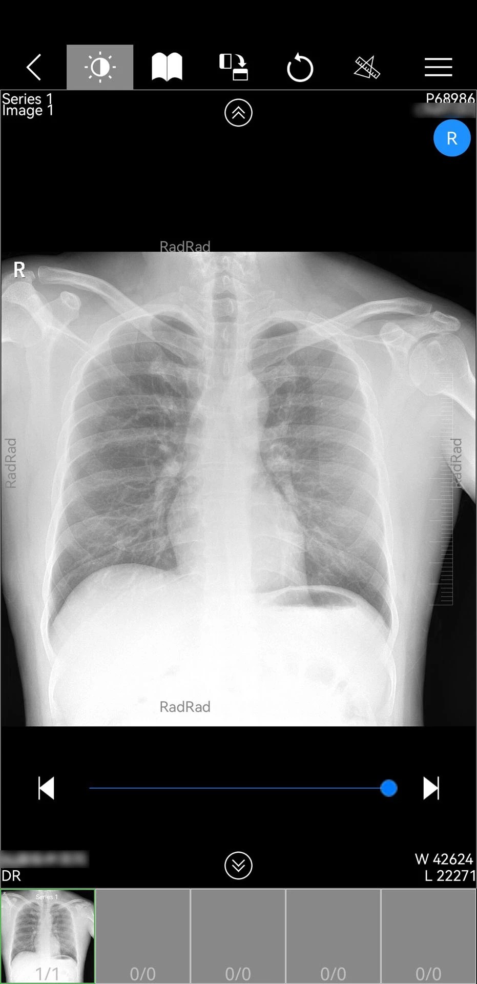 微影医生 v1.18.110