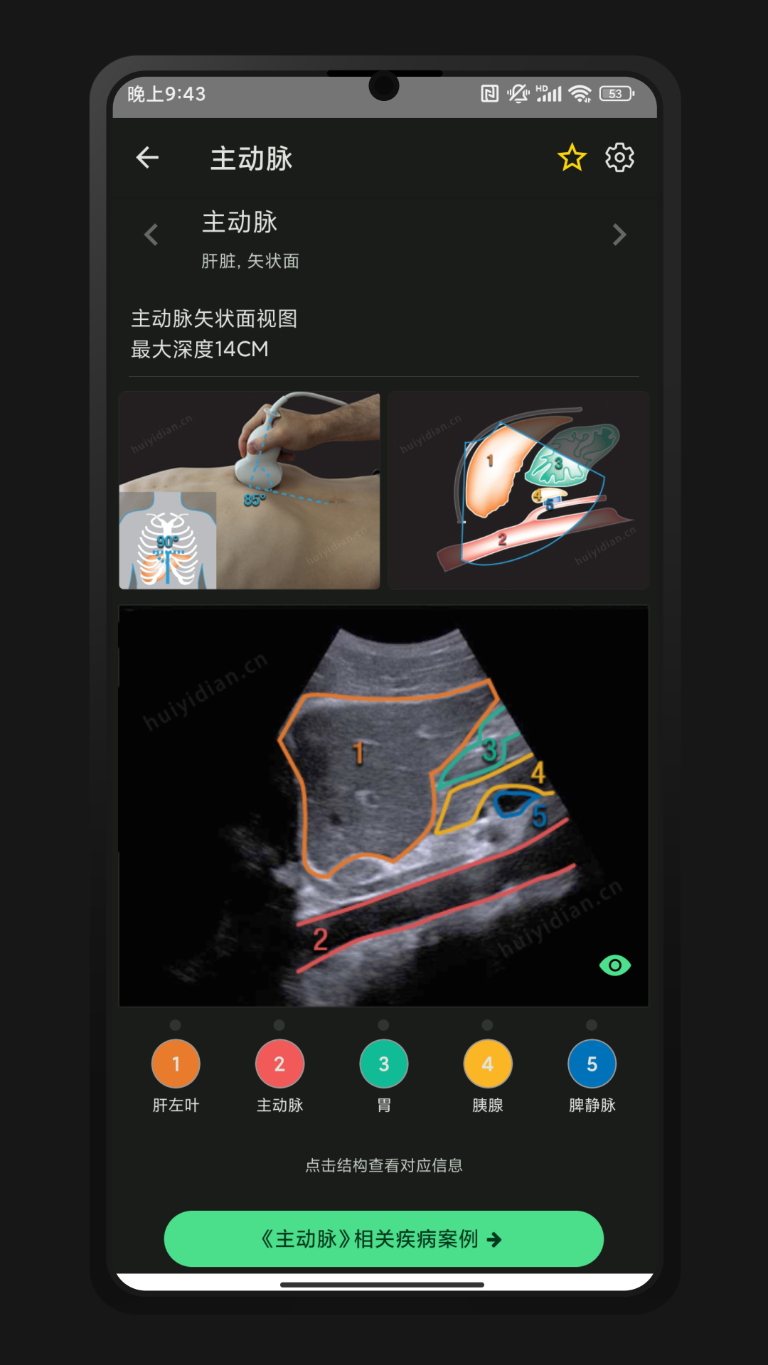 超声智学app安卓版 v2.0.0